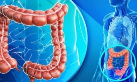 Cáncer de colon: cuáles son los factores de riesgo