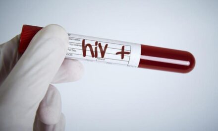 Trasplantes en pacientes con VIH, podrían terminar con tratamientos antirretrovirales